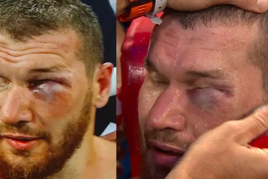 Russian Heavyweight Suffers One Of Most Brutal Eye Injuries Seen