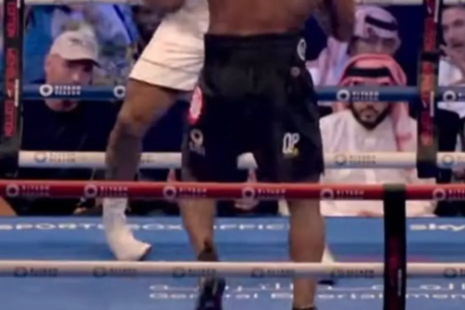 anthony joshua ankle