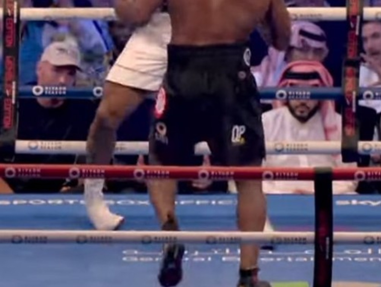 anthony joshua ankle