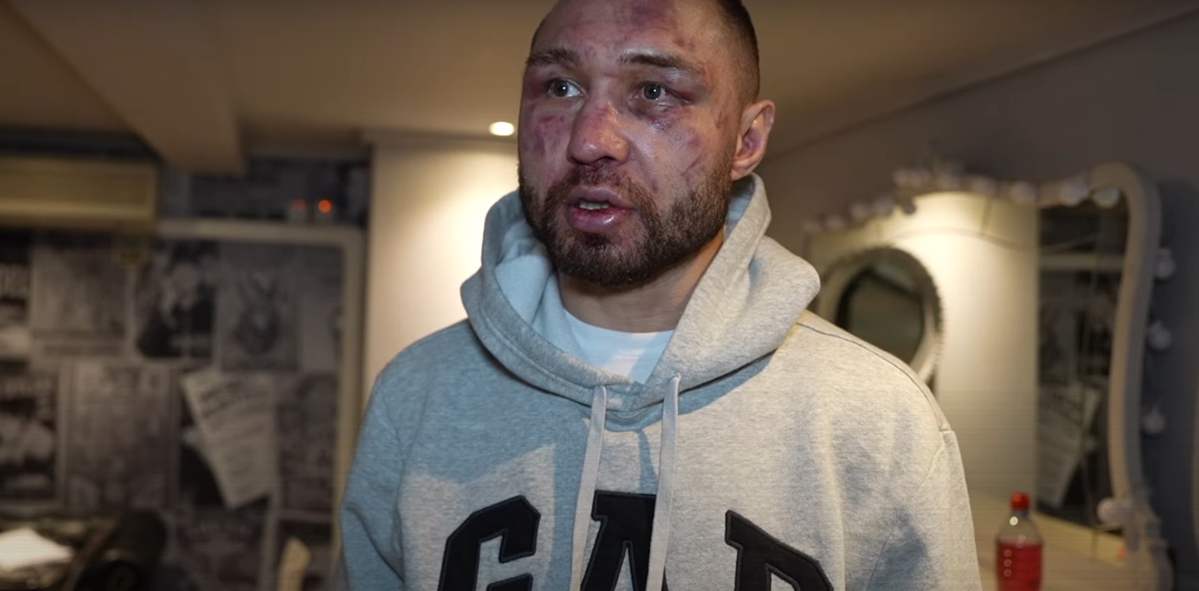 Boxer's Face Brutally Bust Up After Sharing The Ring With The Assassin