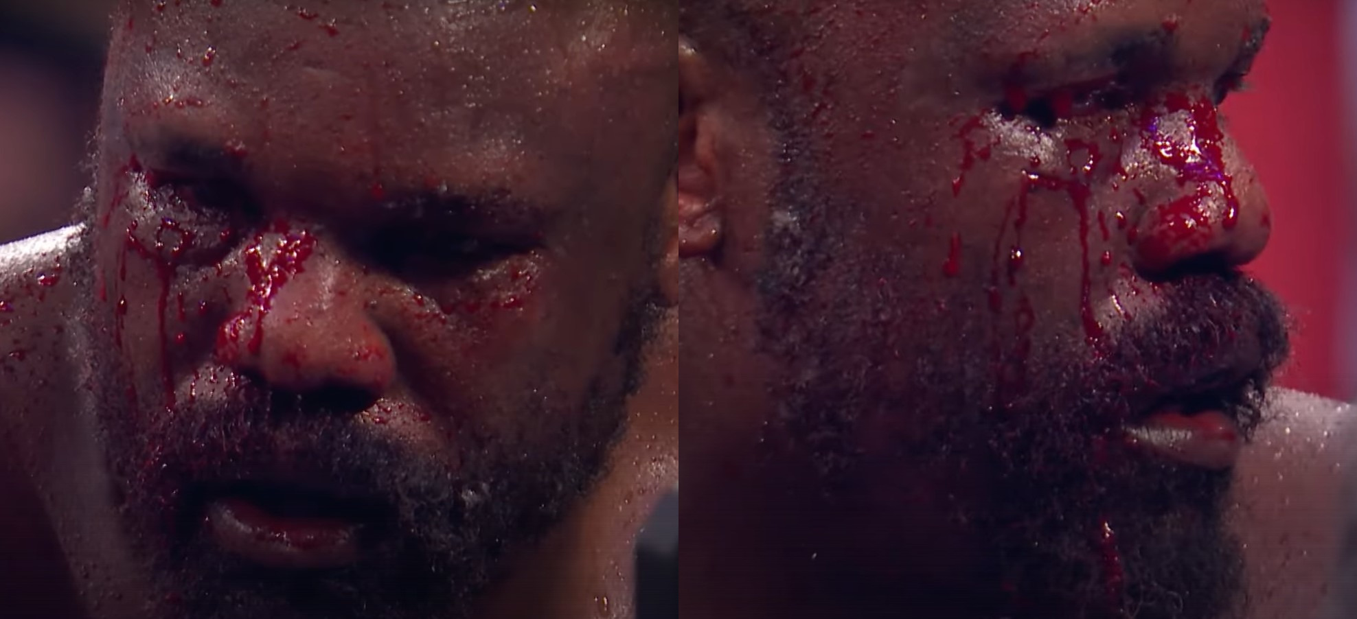 Heavyweight Battles Through Brutal Bloody Bust Up Gruesome Eye Injury