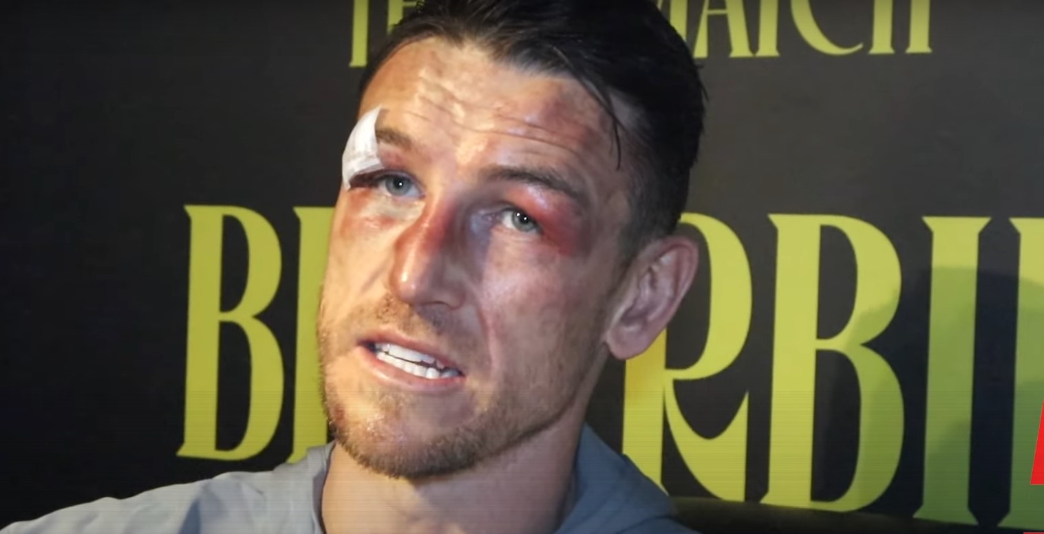 Callum Smith Reacts To Beating Joshua Buatsi