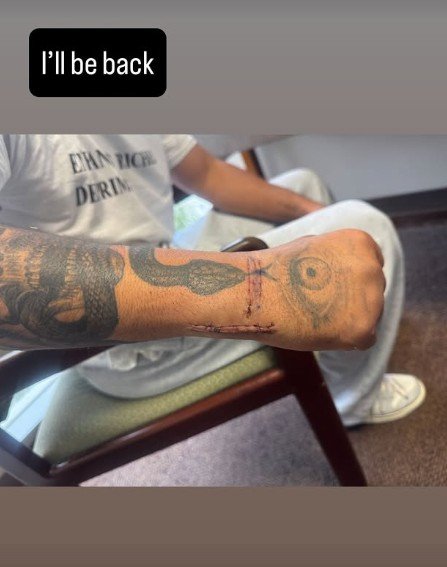 Ryan Garcia Reveals Hand Under Repair Post Surgery After Romero Defeat 3 a1 1